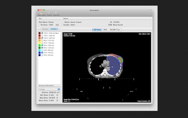 Best MicroDicom Alternatives